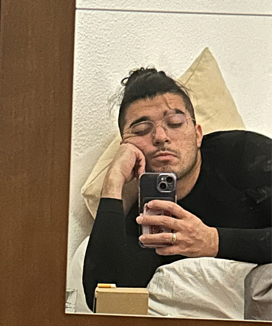 yungmatías