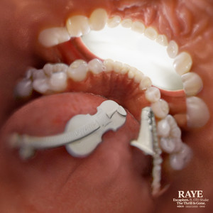 Écouter "Escapism. - Sped Up" de RAYE