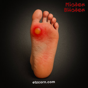 MISTER BLISTER