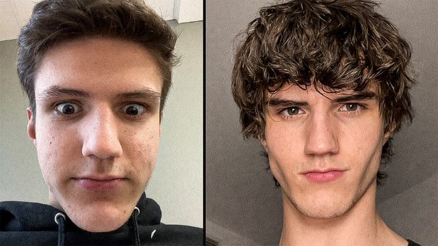 From Botox To $35,000 Jaw Surgery: The Extreme Procedures Promoted At A Looksmaxxing Camp